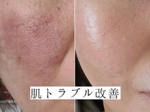 ユウビジン(YOU美人)/