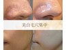 ◇５名様限定◇美白毛穴集中ケア