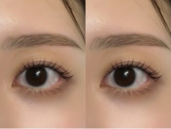エクラ 三軒茶屋(Eclat)の写真/似合わせ美眉アイブロウで一気に垢抜け♪平行/アーチ/ナチュラル眉など骨格に合わせて理想の眉をご提案◎