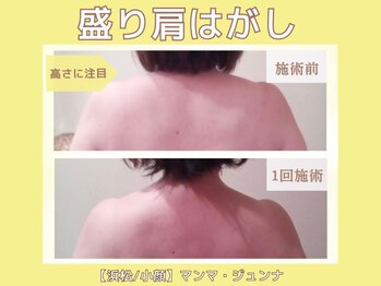 マンマ ジュンナ/もり肩【浜松/小顔/小顔矯正】