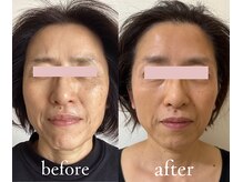 トリートメントルーム フェリーチェ(Felice)/NOファンデ？見た目年齢別人級