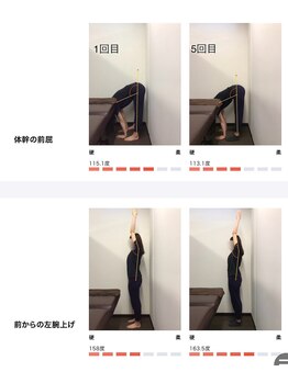 女性専用整体サロン　ベル 岩国店/ 【20代】姿勢Before After