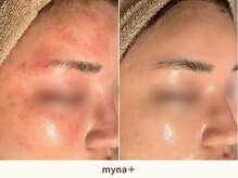 マイナプラ 表参道(myna+)/