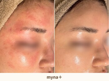 マイナプラ 表参道(myna+)/