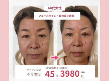 小顔美肌ファクトリー FM富山院の写真/骨格から整える“小顔専門”◇理学療法士監修の本格フェイスメイクサロン