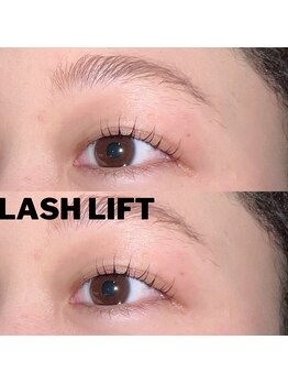 ヴァーリー(valley.)/ラッシュリフト