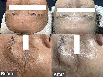 ミルジュ(MiLuJu)/タラソトリートメント