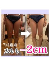 アンリール 旭川店(Anrire)/BODY施術のお客様です！