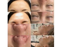 まるでラミネートしたようなツヤ肌＋毛穴シワたるみケアが同時に