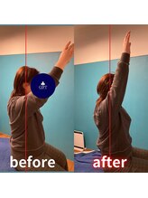 ギフトリラクゼーション 久留米(GIFTリラクゼーション)/☆before　after☆