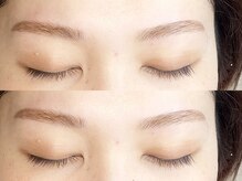 ネネ(nene.)/Hollywood brow lift