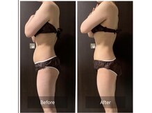 インナーメス(INNER MES)/【一番人気】全身徹底痩身！