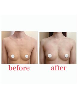 ブロッサム 山内店/細身の方でもこの効果☆