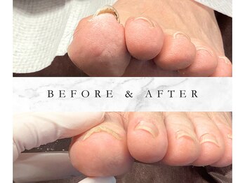 月一回ご来店いただきます