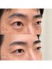 【U24メンズ限定】眉毛Wax脱毛 モニター価格!