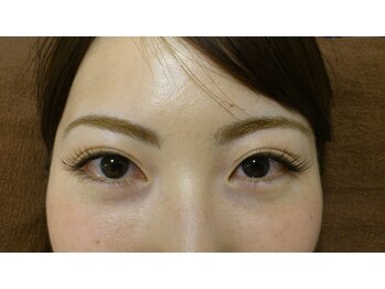 ルビジュー(le bijou)/80本