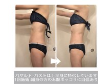 ラ ルミエール(La Lumiere)/痩せ型の方のお腹にも結果でます