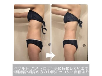 ラ ルミエール(La Lumiere)/痩せ型の方のお腹にも結果でます