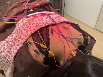 明円鍼灸治療院の写真/辛い首肩コリにお悩みの方へ＊熟練オーナーによる電気鍼でやみつきになるスッキリ感！美容鍼とのセットも◎