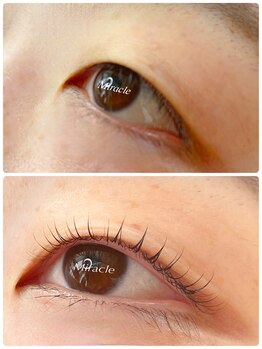 まつげアンド目元美容専門店 ミラクル(Miracle)/