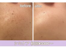 リラ(LILAS)