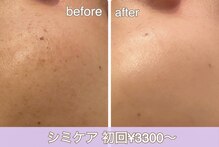 リラ(LILAS)