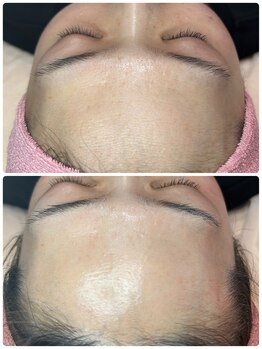 カーム(CALM)/艶肌完成