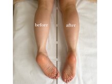 リコット(Licott)/before after写真