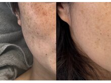 モガナ(mogana)/半年パスポートでご来店♪