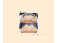 オベリオ(OBERIO)/