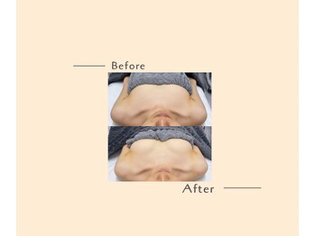 オベリオ(OBERIO)/