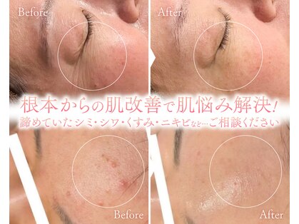 ウィンウィン 周南店(Win Win)の写真