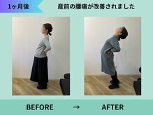 トミーリハ整体院(TOMMY REHA整体院)/産前の辛い腰痛改善