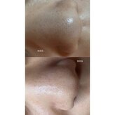 ソワンドボーテ クー(Soin de Beaut'e Quu)