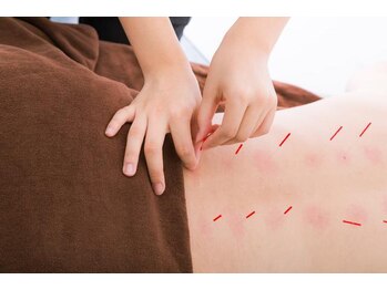 松戸駅前鍼灸院 整骨院/全身鍼