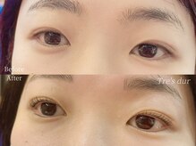 トレデュール 長町南店(Tre's dur)/似合わせまつげパーマ