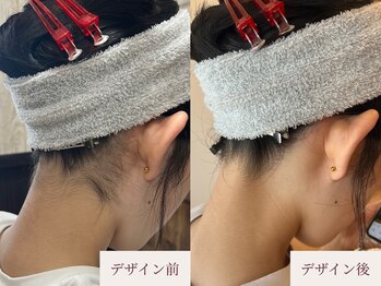 クラームビューティー(Clerm beauty)/美容師によるうなじデザイン脱毛