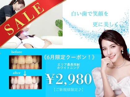 ホワイトニングショップ 熊谷店の写真