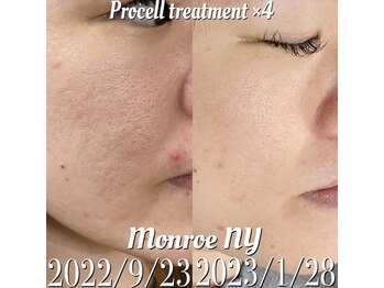 サラシック(salachic)/プロセルフェイシャル