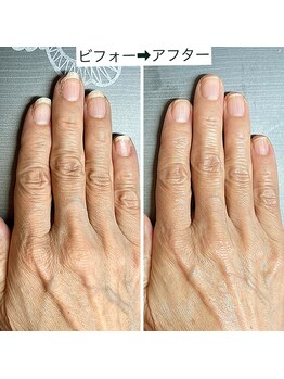 ハンドケアで潤う手　3