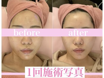 小顔美肌コルギ専門店 センティード 吉祥寺(Sentido)/施術写真