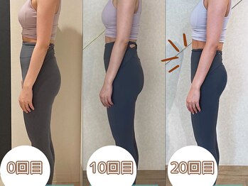 ラティコ(LATECO)/Before＆After