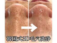 ラウーム 下北沢(lawomb)の雰囲気（まずはフェイシャルから毛穴洗浄（毛穴の開き・黒ずみを改善））