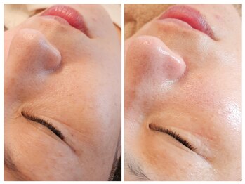 サロン ザ プマロ(SalonThePumalo)/ツヤ肌反射フェイス