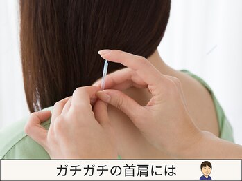 たか鍼灸接骨院/【ガチガチ首肩に】深層鍼