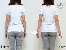 エーアール(AR)/【Before/After】　
