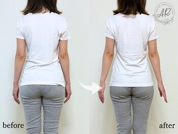 エーアール(AR)/【Before/After】　