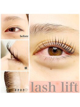 グレイス(grace)/