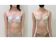 ワイサロン(Y salon)/バストアップ/4ヶ月/B→Dカップ