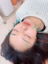 ヒーリングサロン アージュ(A-je)/★美顔鍼＋小顔矯正★